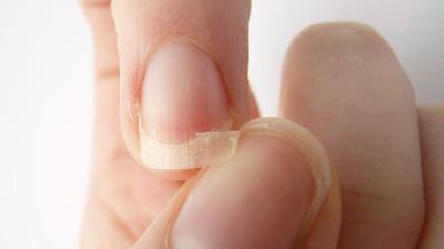 چه علت هایی باعث شکستن ناخن ها می شود