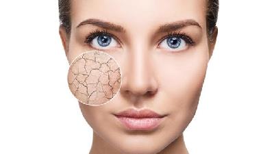 برای خشکی پوست چه درمان های سنتی وجود دارد