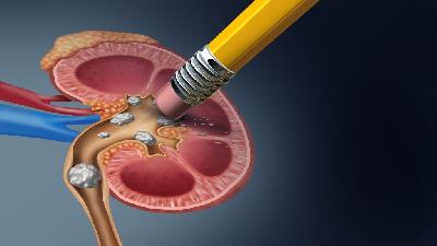 چه خوراکی هایی برای درمان سنگ کلیه خوب است