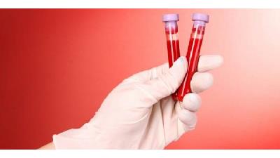 چه خوراکی هایی برای درمان غلظت خون خوب است