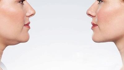 برای اینکه چربی صورت ما از بین برود چه کارهایی باید انجام بدهیم