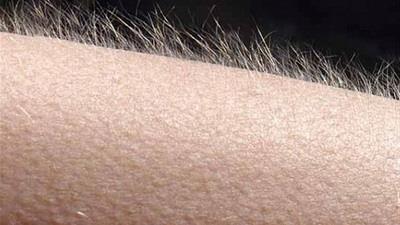 چرا موی تن ما سیخ می شود