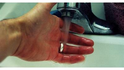 دست خود را برای درمان سوختگی زیر شیر آب بگیرید