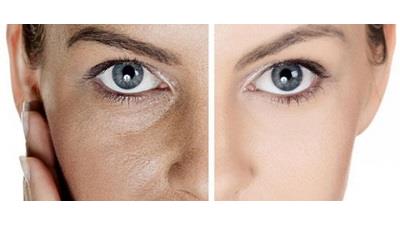 برای سفید شدن پوست چه روش های خانگی وجود دارد