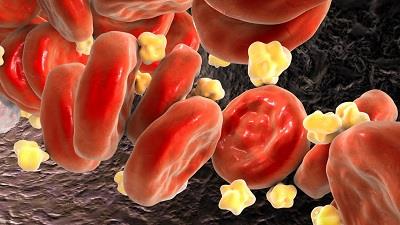 توصیه طب سنتی برای کاهش چربی خون