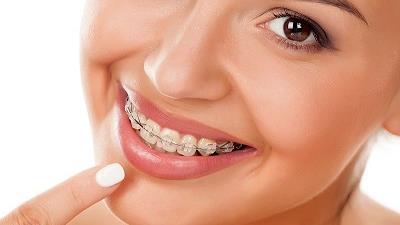 یک کلینیک ارتودنسی مناسب چه ویژگی هایی دارد؟