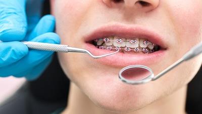 یک کلینیک ارتودنسی مناسب چه ویژگی هایی دارد؟