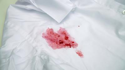 روش های طبیعی برای تمیز کردن لکه های لباس چیست