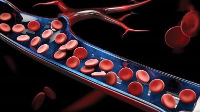 با دلایل و علائم سندروم شوک سمی آشنا شوید
