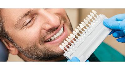 ارزش خرید کامپوزیت