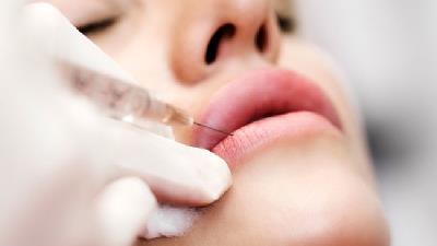 مراقبت های لازم بعد از تزریق ژل به لب ها