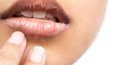 راه های درمان ترک لب چیست