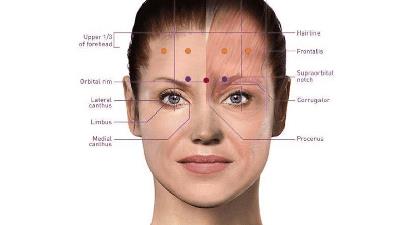 آیا تزریق بوتاکس می تواند در درمان میگرن مزمن اثر بخش باشد؟