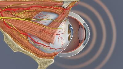 سکته چشمی چه دلایل و علائمی دارد