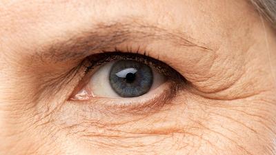 تاثیر آلودگی هوا بر پیری زودرس پوست و راه‌های مقابله