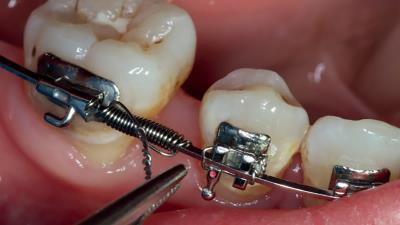 چرا کویل اسپرینگ ها توصیه می شوند؟