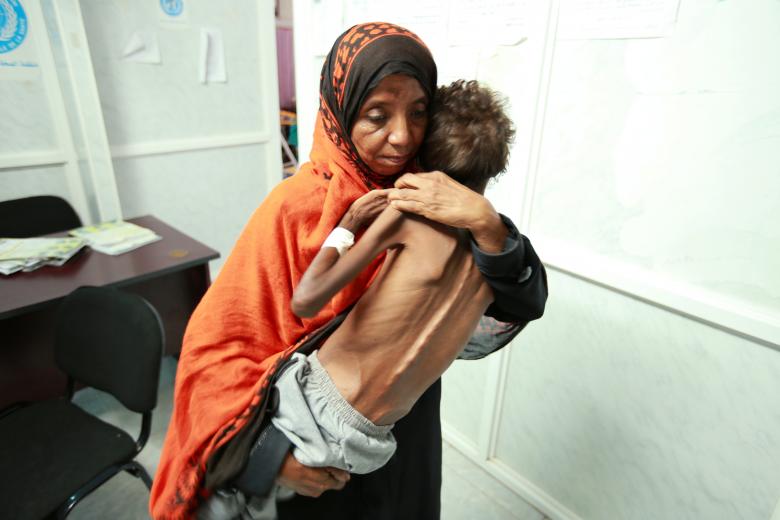 فاجعه قحطی در یمن ادامه دارد