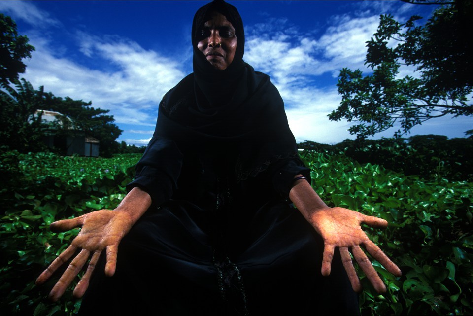 آب‌های آلوده  بنگلادش؛ یکی از بزرگترین بحران‌های بهداشتی  جهان