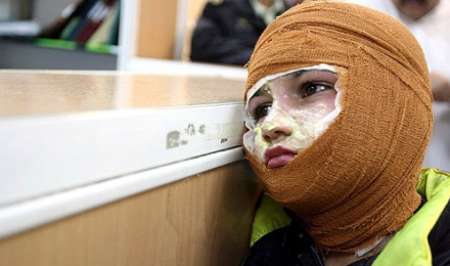 شعله‌های مرگ، ضجه های درد