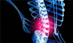 علل شایع گرفتگی کمر