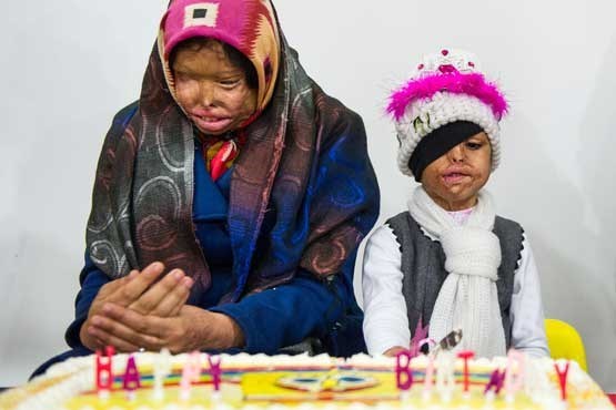 حکم قصاص برای عامل اسیدپاشی روی همسر و فرزند