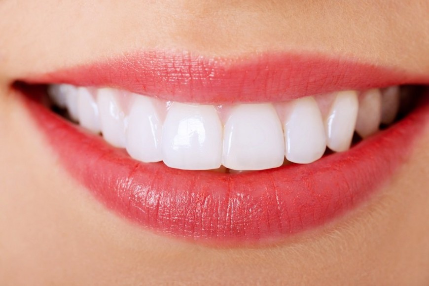 افراط در انجام روش‌های زیبایی دندان باعث زشتی می‌شود