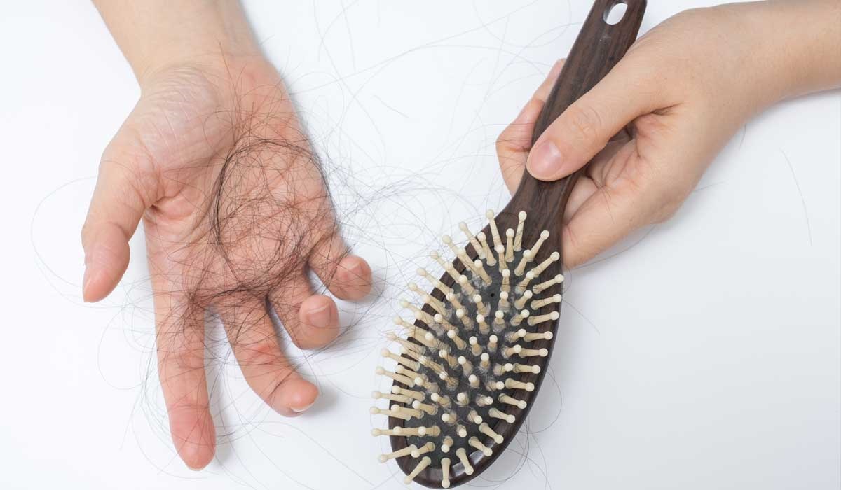 شایع‌ترین نوع ریزش مو و راه‌های درمان