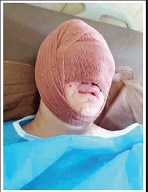 سرنوشت تلخ زنی که قربانی اسیدپاشی شد