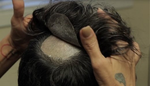 بازداشت ۹ نفر به خاطر کاشت مو و مژه زیرزمینی