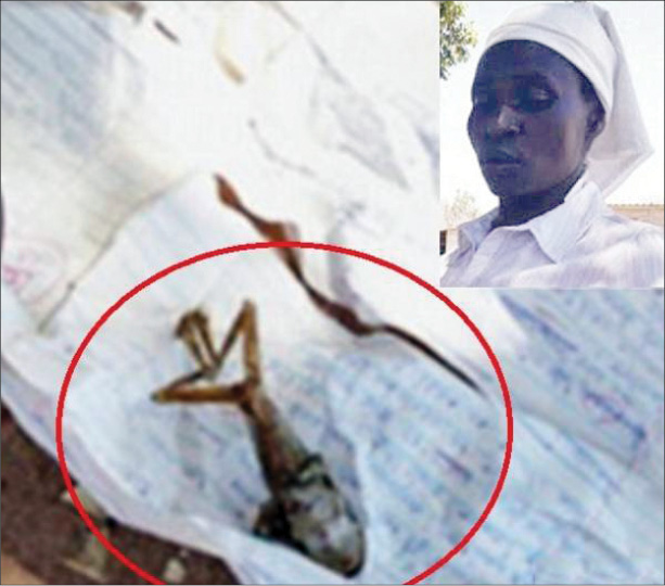 زن باردار بچه قورباغه زایید