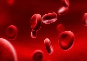 نشانه‌ها و انواع کم خونی و راه‌های درمانی
