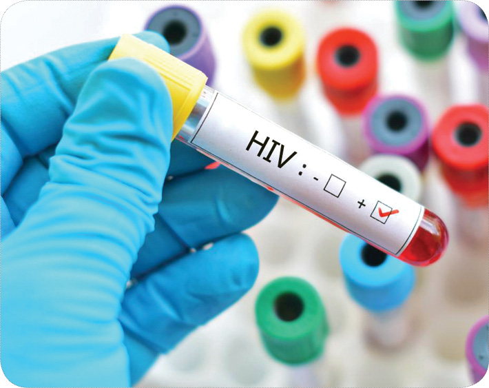 مهم‌ترین نکاتی که درباره ایدز باید بدانیم