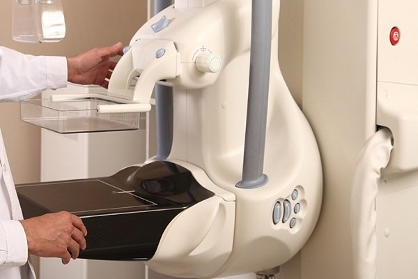 بهترین زمان برای انجام ماموگرافی خانم‌ها چند سالگی است؟