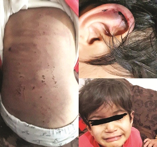 شکنجه ستایش 5 ساله توسط نامادری