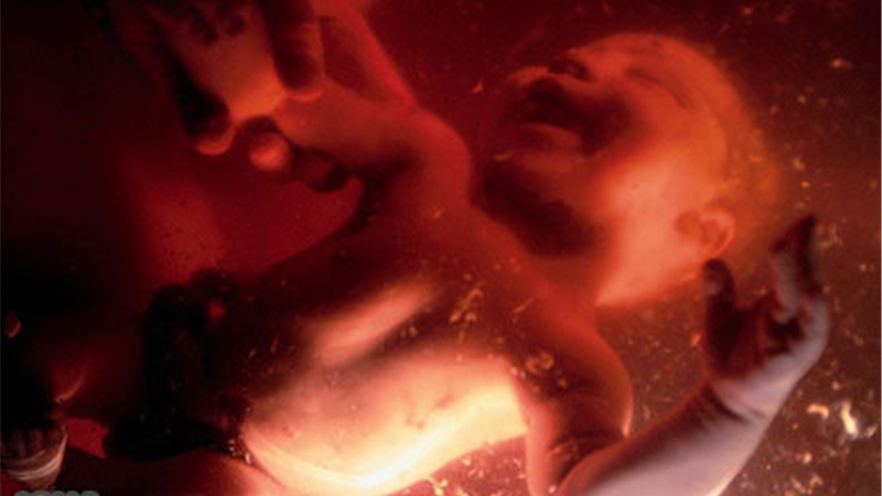 مجبور شدم سقط جنین کنم