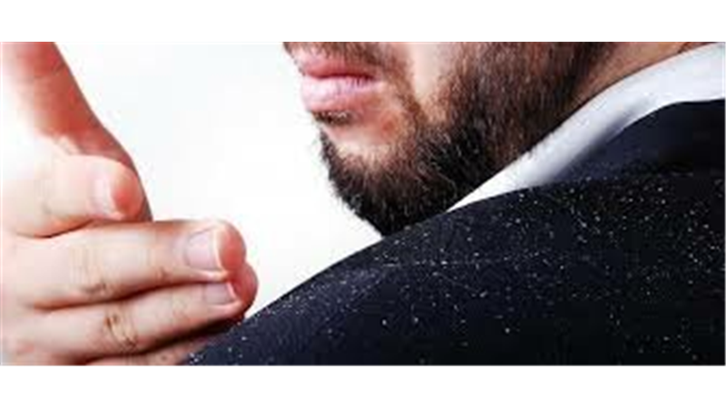 برای از بین بردن شوره و خارش پوست سر چه کار کنیم