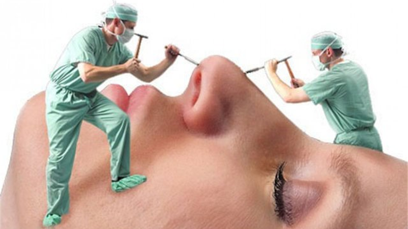 آیا کوچک کردن بینی با تزریق ژل واقعی است