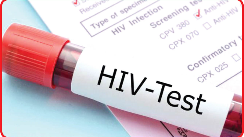 رابطه رفتار های پرخطر جنسی و ابتلا به ایدز