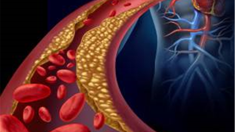 درمان طبیعی کلسترول بالا با طب سنتی