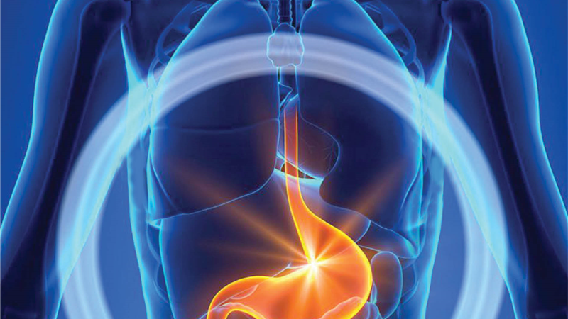 سرطان معده چه علایم و نشانه‌هایی دارد