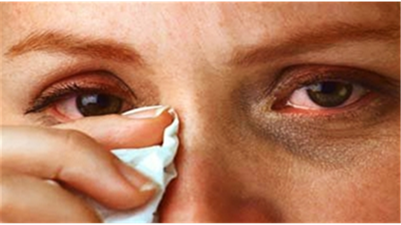 دلیل حساسیت چشـم و راه پیشگیری و د‌‌‌‌رمان چیست