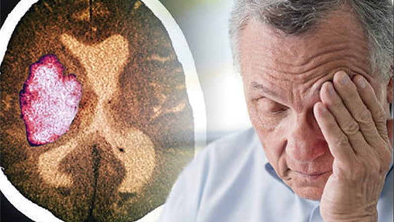 علایم و نشانه‌های سکته قلبی و مغزی + دلایل و راه پیشگیری