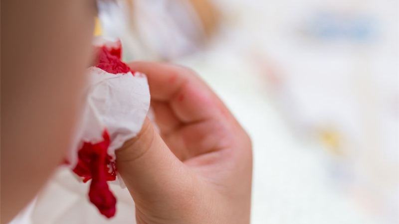 جزییات کامل؛ دلایل خون دماغ شدن چیست و چه باید کرد