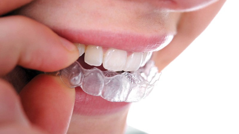 ارتودنسی نامرئی چه مزایا و معایبی دارد