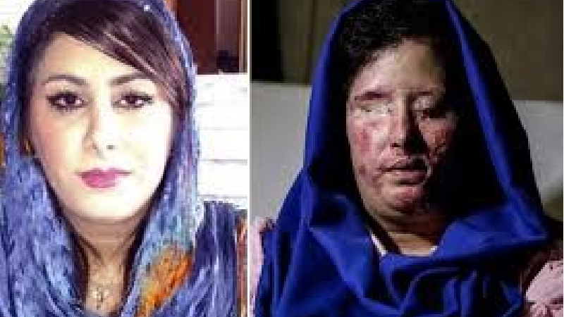 پرونده اسیدپاشی‌های اصفهان چه شد