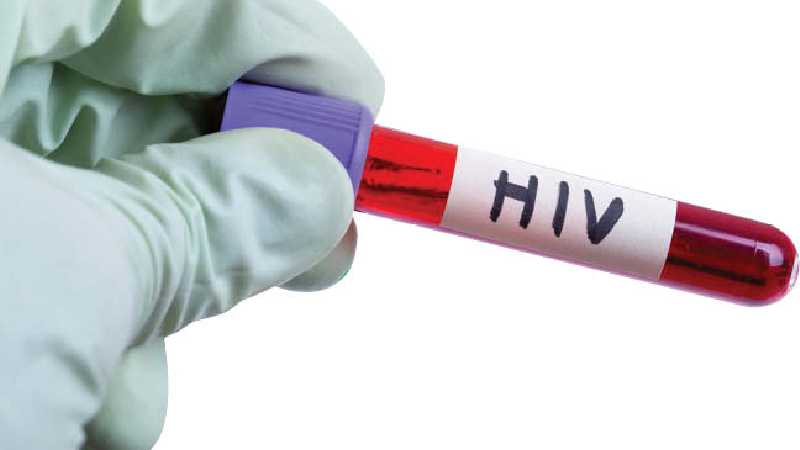 ابتلا ایدز چه زمانی مشخص می شود و چه علایمی دارد