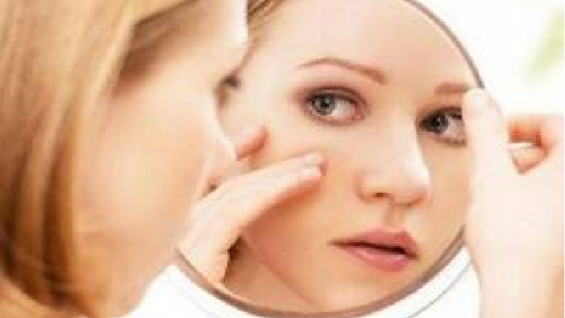 آکنومیس چیست و چه تاثیری روی جوش‌های صورت دارد