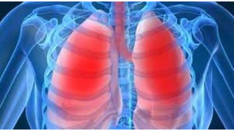 علایم بیماری سل و راه‌های انتقال آن چیست