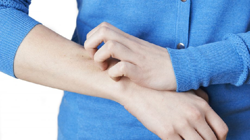 بیماری زونا چیست و چه علائم و عوارضی دارد