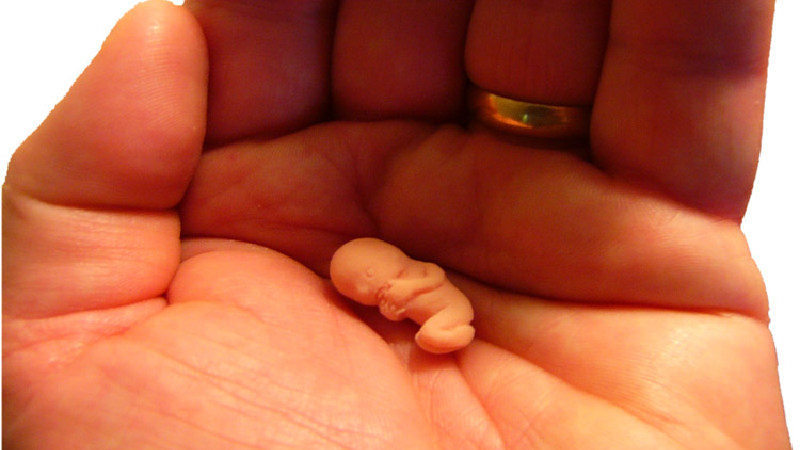 عوارض سقط جنین عمدی برای زنان